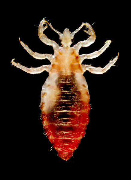 Head Lice