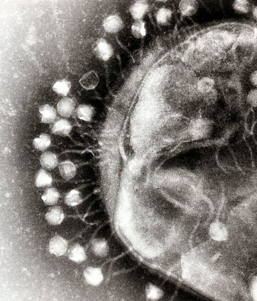 Bacteriophages attached to larger host cell.