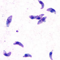 Toxoplasma parasite