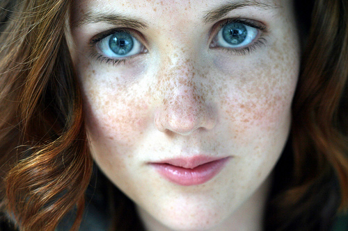Who would want to take away her freckles? This woman is GORGEOUS!! 