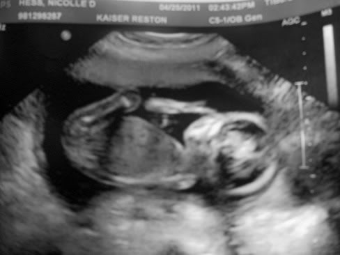 Ultrasound Picture 