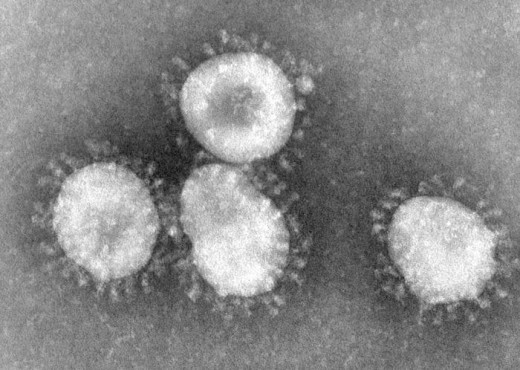 Here is the virus that causes the common cold. 