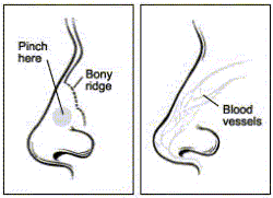 Diagram shows how you should hold your nose to stop the bleeding