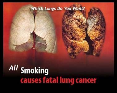 The grave consequences of smoking
