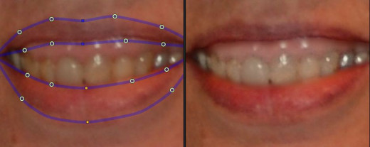 In this image PP11 treated the top gums as teeth and lightened them.