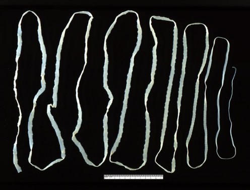 An Adult Tapeworm (Taenia).