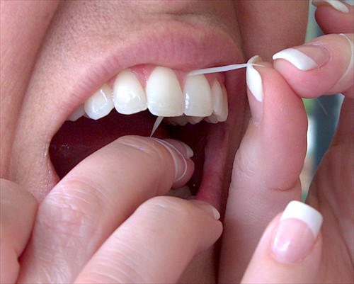 Flossing can reduce your chance of losing teeth later in life by strengthening your gums. 