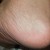 Take care of cracked skin on heel like this before it goes worse Take care of cracked skin on heel like this before it goes worse