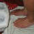 Dry the feet after they are clean Dry the feet after they are clean