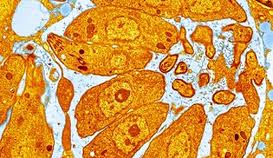 Toxoplasma parasites. Not too much to worry about for most, but pregnant women should take care to avoid exposure.