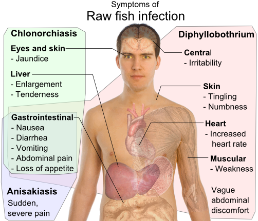 Parasite infection is rare in raw fish