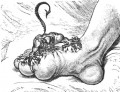 Prescription Remedies For Gout