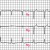 Classic WPW EKG