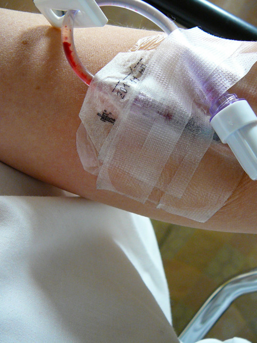 Chemotherapy agents are sometimes delivered via IV.