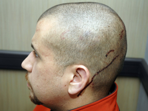 This Feb. 27, 2012 photo released by the State Attorney's Office shows George Zimmerman, the neighborhood watch volunteer who shot Trayvon Martin. The photo and reports were among evidence released by prosecutors that also includes calls to police, v