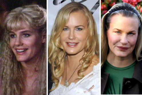 Daryl Hannah before and after plastic surgery. The first picture is from her early years as an actress.