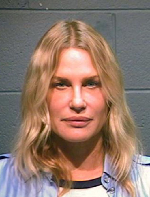A mug shot - after surgery.