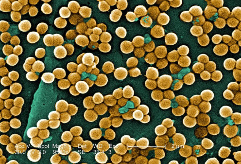 MRSA 