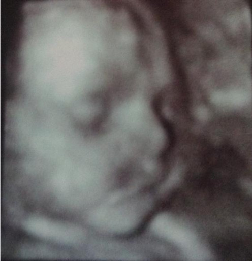 Isn't it amazing how these 4-D images can be accessed so you know what the child looks like while still in the womb?