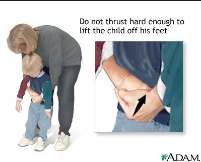 Choking do's and don't 