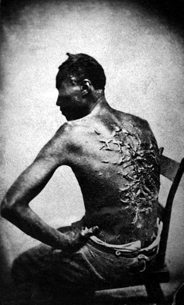 However badly they were treated when they came North, nothing could compare with the brutality and cruelty slaves had suffered at the hands of their owners. This former slave was photographed after he escaped to the North.