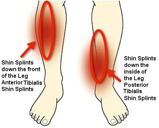 What are some stretching exercises for the shin and lower leg?