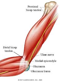 Ruptured tendon
