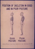 Exercises to Improve Posture