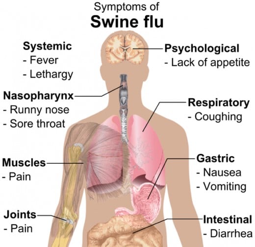 Swine Flu is a respiratory illness but it can affect other parts of the body as well.