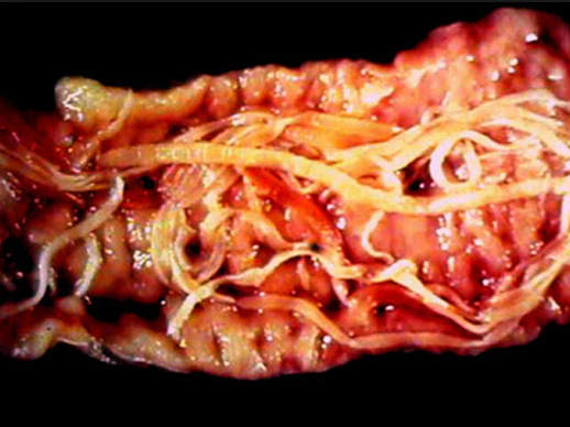 Parasites inside the pigs' belly~