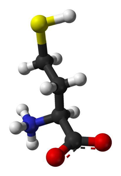 Homocysteine By Ben Mills and Jynto [Public domain], via Wikimedia Commons