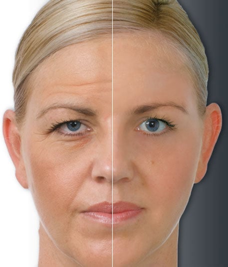 Before and after results of skin treatment