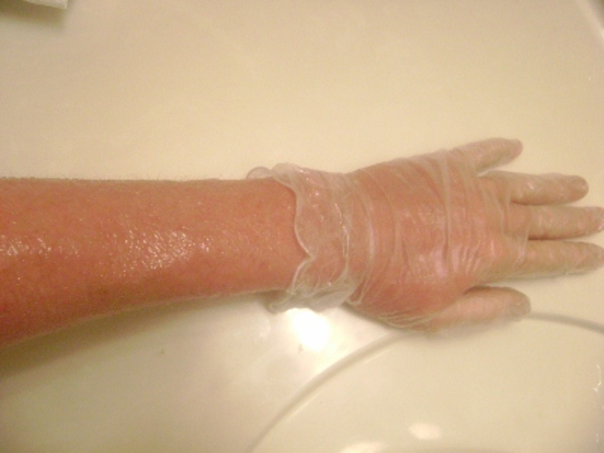 Thin skin after steroid cream