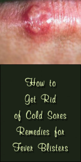 how-to-get-rid-of-cold-sores-quickly-hubpages