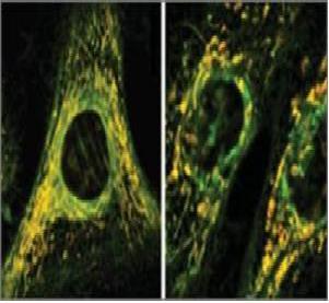 This figure shows the effect of oxidative stress on mitochondria. A long highly branched normal mitochondria of a healthy cell (left). Short, unbranched mitochondria after the treatment with antibiotics (right).  