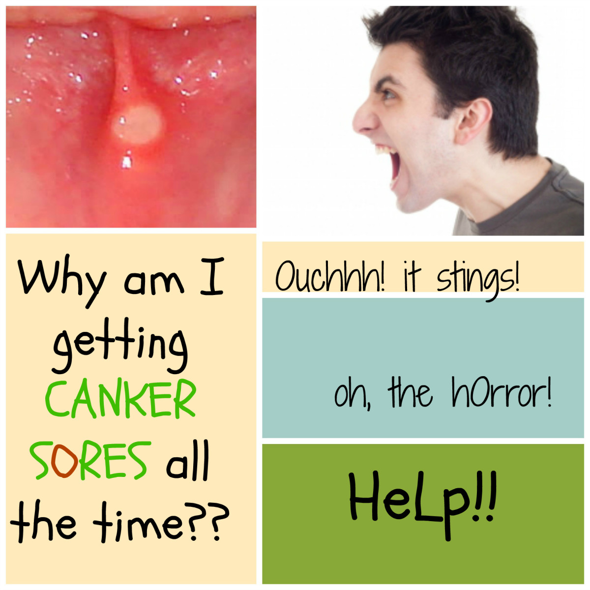 what causes canker sores