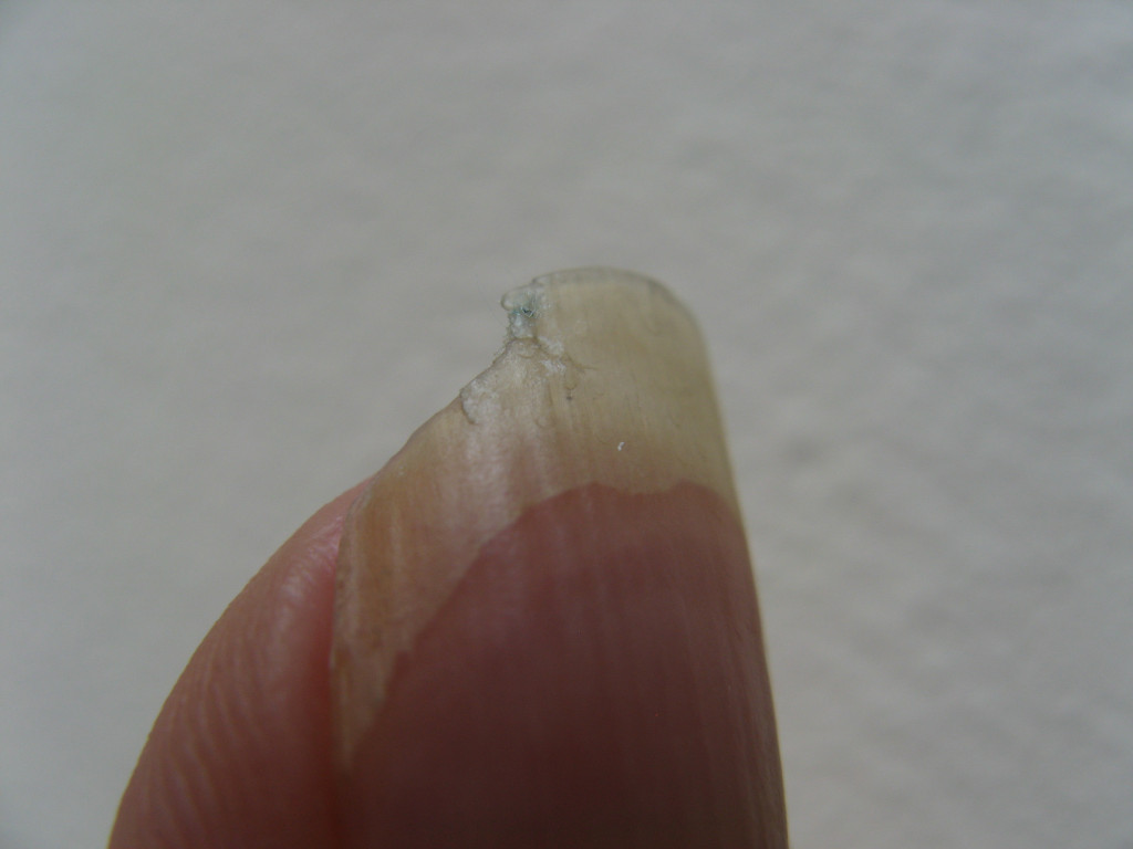 How I Fixed My Broken Split Fingernails Naturally HubPages