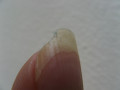 How I Fixed My Broken Split Fingernails Naturally