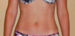 Best stomach exercises will help you lose belly fat fast. Best stomach exercises will help you lose belly fat fast.