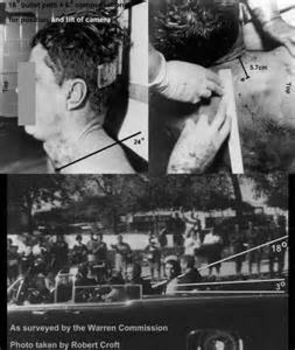 Photos From The Dead Body Of President Kennedy. 