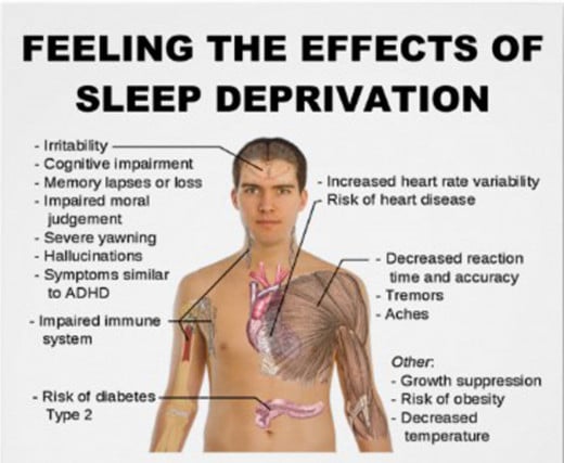 The effects of sleep deprivation