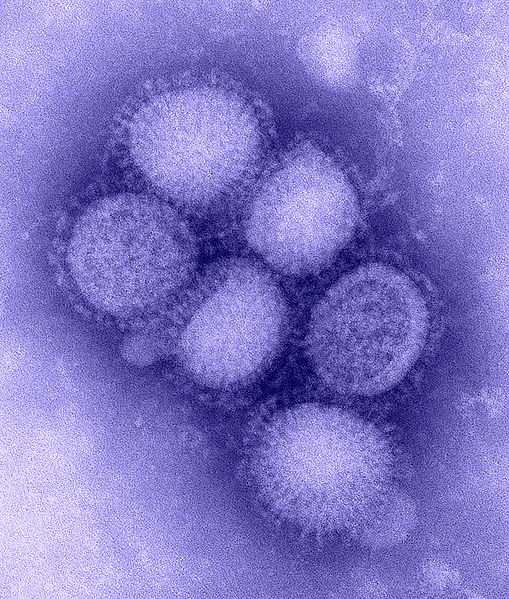 H1N1 Influenze Virus taken from the CDC Influenza Laboratory