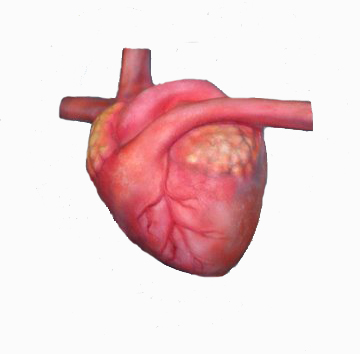 What an actual human heart looks like.