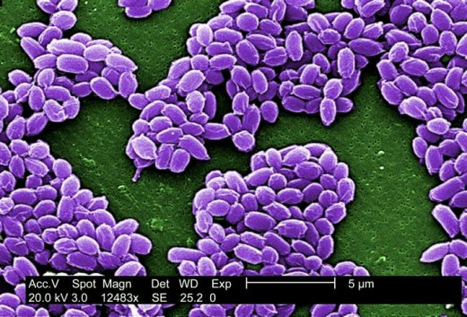 Anthrax spores