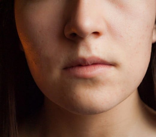 What medicine treats facial numbness?