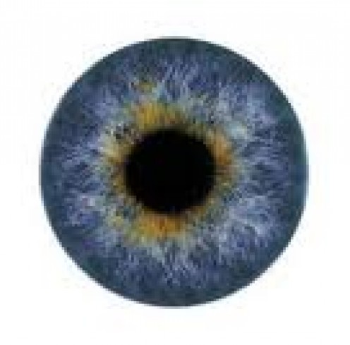Excessive Eye Blinking and Squeezing May Be a Movement Disorder Called Blepharospasm Excessive Eye Blinking and Squeezing May Be a Movement Disorder Called Blepharospasm