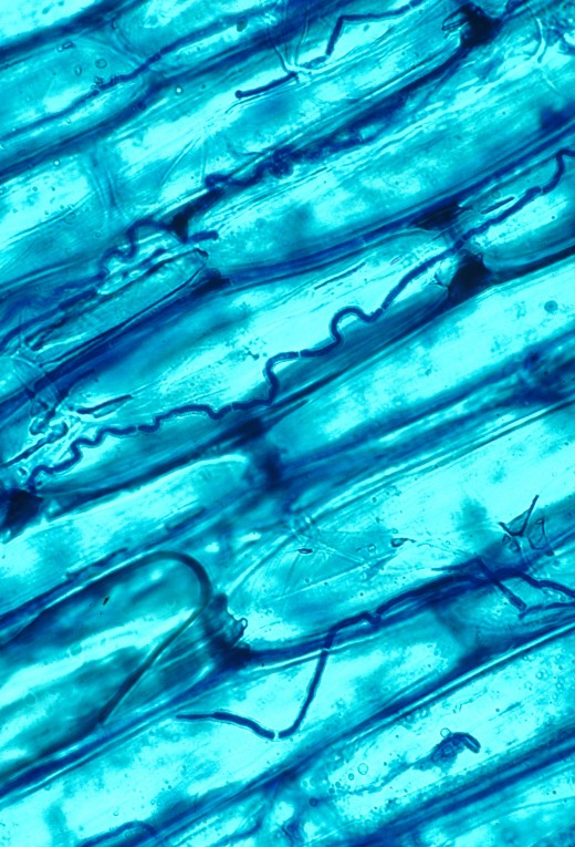 Detail on hyphae growing between plant cells.
