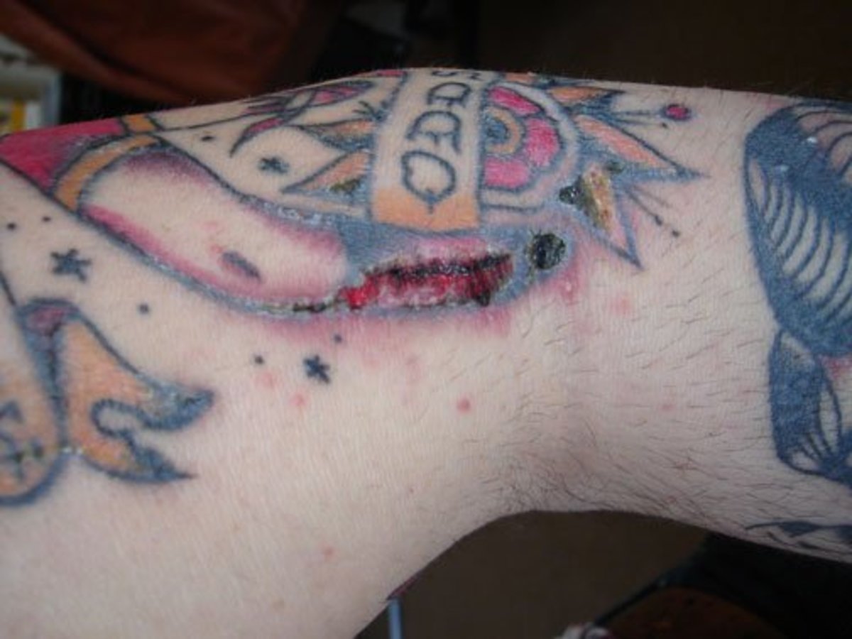 Red, sore, infected  leg tattoo
