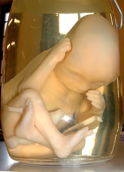 Fetus