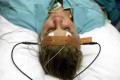 Electro-convulsive therapy (ECT) - the facts and controversies about ECT